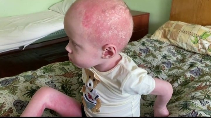 Била сына раскаленной сковородкой: в соцсетях Рыбинска мать обвинили в жестоком обращении с ребенком